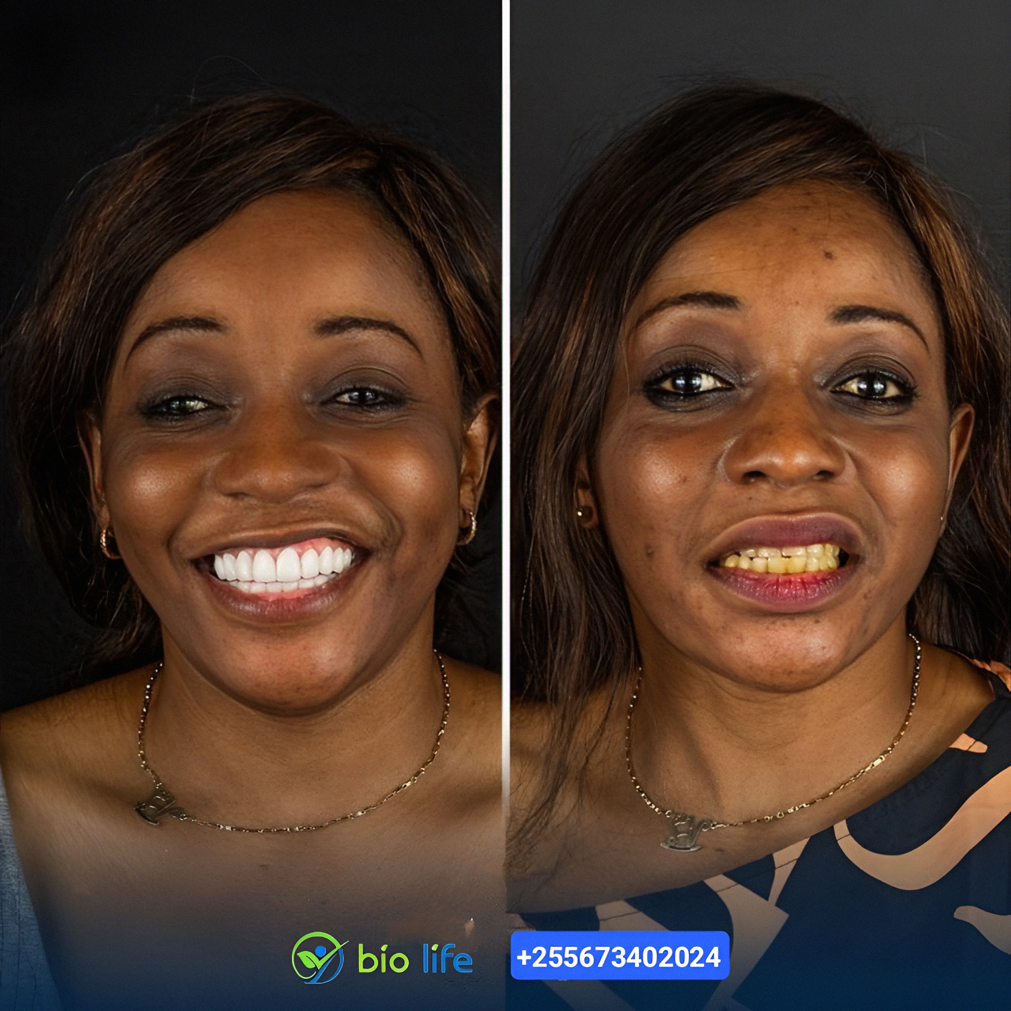 DAZZLING WHITENING PEN